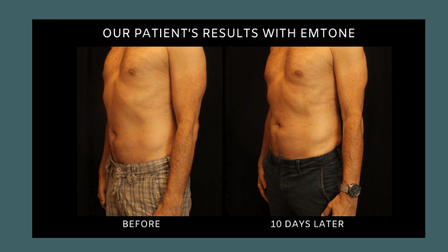 EMtone Results